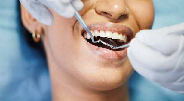 Best Emergency Tooth Extraction in Reidsville, GA