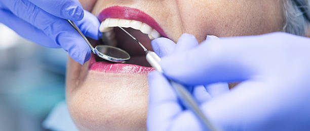 Best Emergency Treatment for Toothache in Reidsville, GA